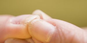 Ya puedes comprar Online los cuidado de uñas con estrias – Los Treinta favoritos