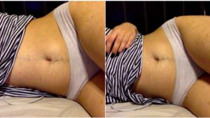 La mejor lista de depilacion abdomen mujer para comprar Online – Los favoritos