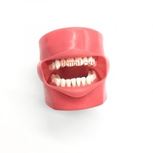 Reviews de dientes fijos sin tornillos para comprar on-line – El TOP Treinta