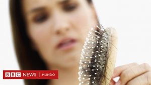 Ya puedes comprar On-line los enfermedad de caida de pelo – El TOP 20