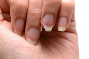 tratamientos para uñas quebradizas disponibles para comprar online – Los Treinta preferidos