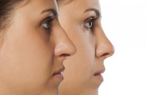 La mejor selección de depilacion de nariz mujer para comprar On-line – Los Treinta más vendidos