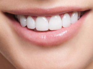 La mejor lista de implantes dentales sin tornillos para comprar On-line – Favoritos por los clientes